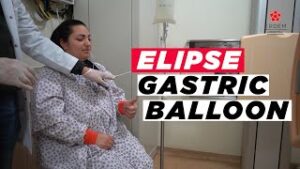 ELIPSE GASTRIC BALLON PROCEDURE